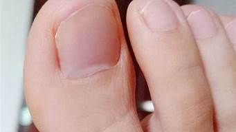几年的灰指甲能治好吗(十多年的灰指甲很严重可以治疗吗?)