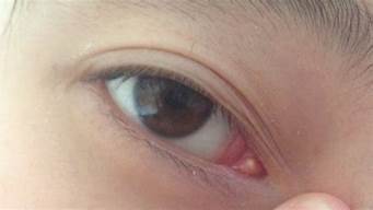 眼角有白色分泌物是什么原因(宝宝眼角有白色分泌物是什么原因)