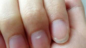 指甲里有白色斑块是什么原因(指甲上有白色的斑块)