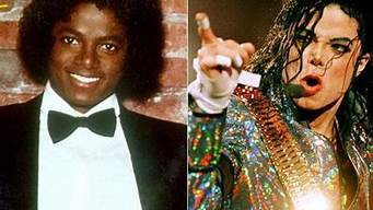 迈克尔杰克逊变白是因为什么(迈克尔杰克逊的皮肤为什么会变白)