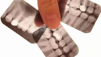 拍牙片的辐射多久从人体消失(拍牙片子的辐射多久消失)